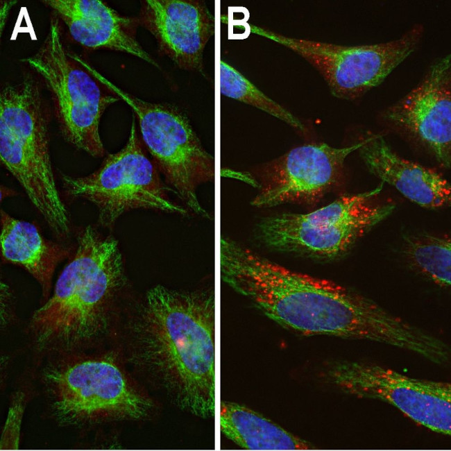 Ubiquitin Antibody in Immunocytochemistry (ICC/IF)