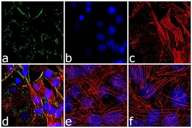 Perilipin 1 Antibody in Immunocytochemistry (ICC/IF)
