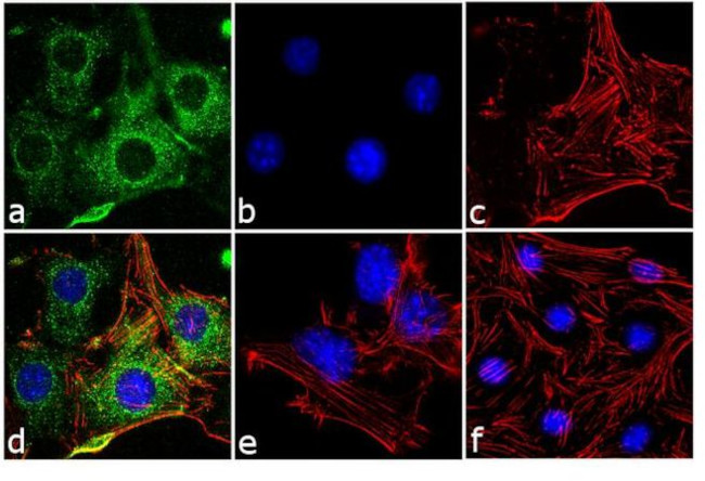 Adiponectin Receptor 2 Antibody in Immunocytochemistry (ICC/IF)