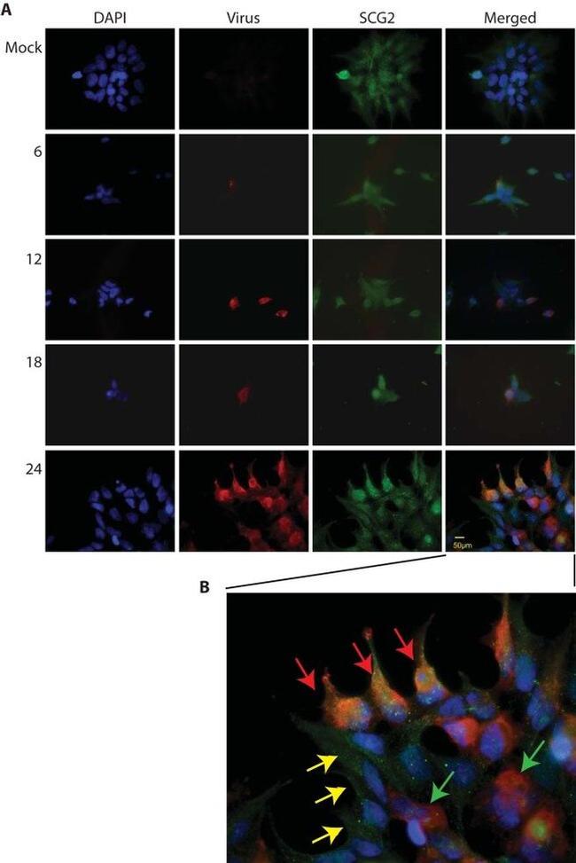 Chromogranin C Antibody in Immunocytochemistry (ICC/IF)