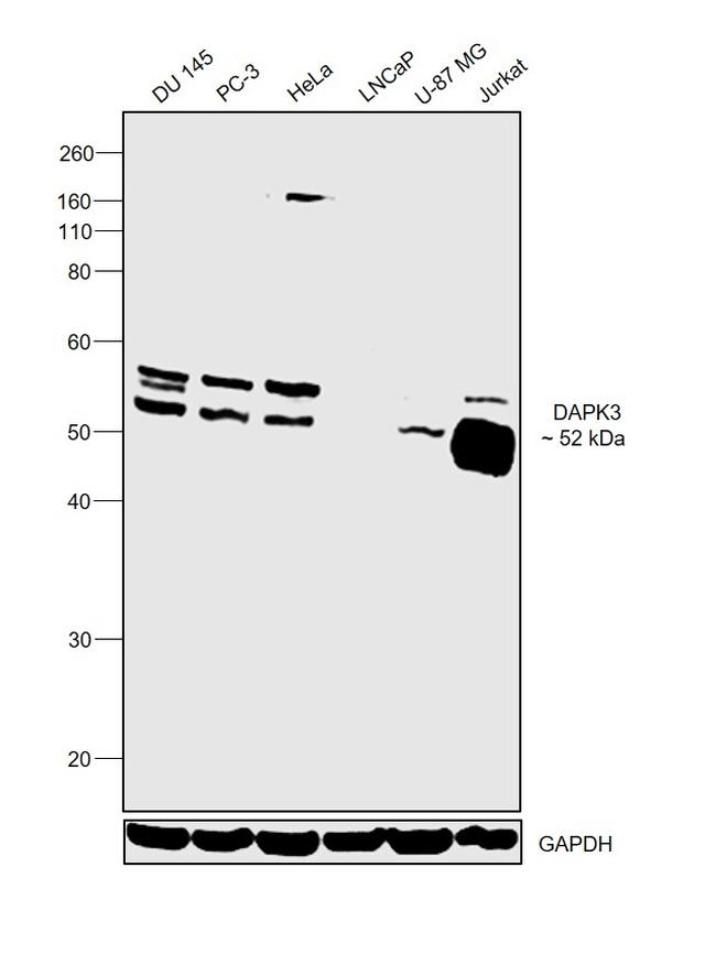 ZIPK Antibody in Western Blot (WB)