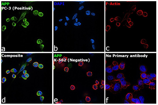 beta Amyloid Antibody in Immunocytochemistry (ICC/IF)
