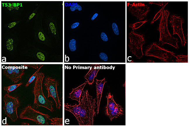 53BP1 Antibody in Immunocytochemistry (ICC/IF)
