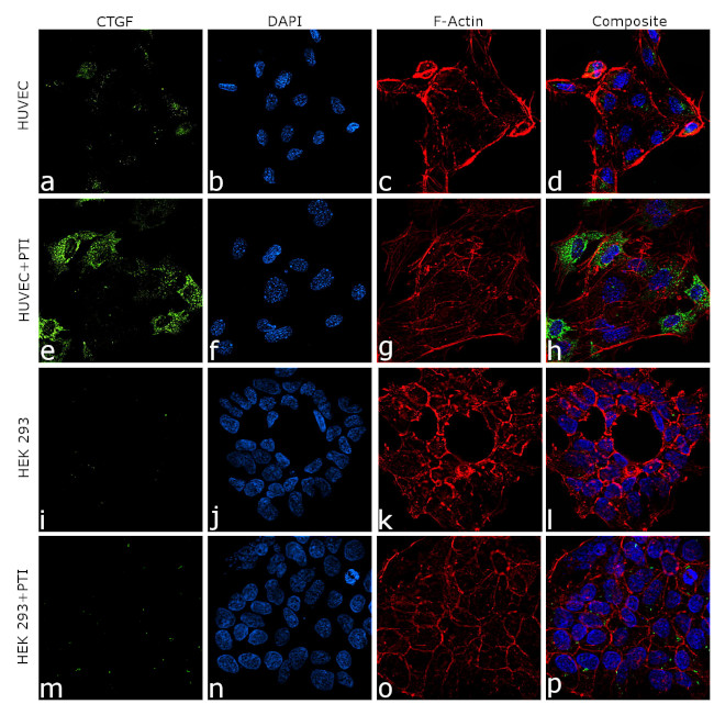 CTGF Antibody in Immunocytochemistry (ICC/IF)