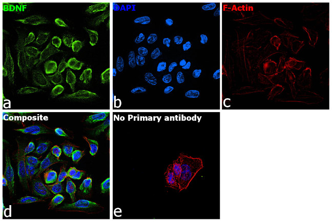 BDNF Antibody in Immunocytochemistry (ICC/IF)
