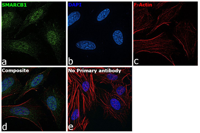 SMARCB1 Antibody in Immunocytochemistry (ICC/IF)
