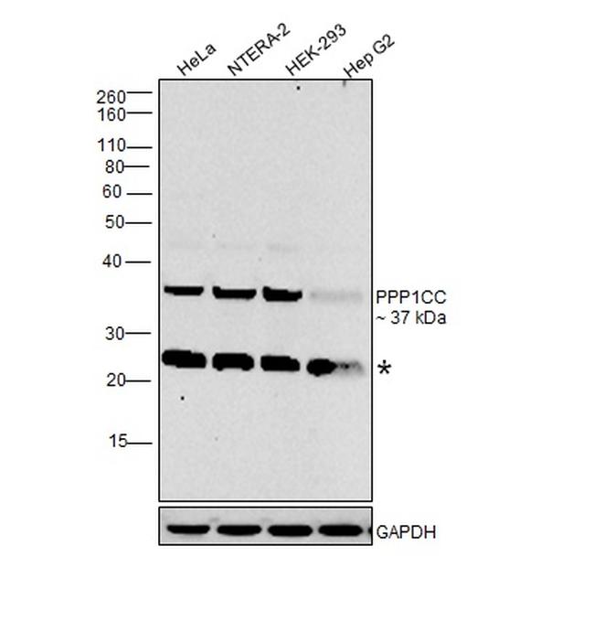 PP1 gamma Antibody in Western Blot (WB)