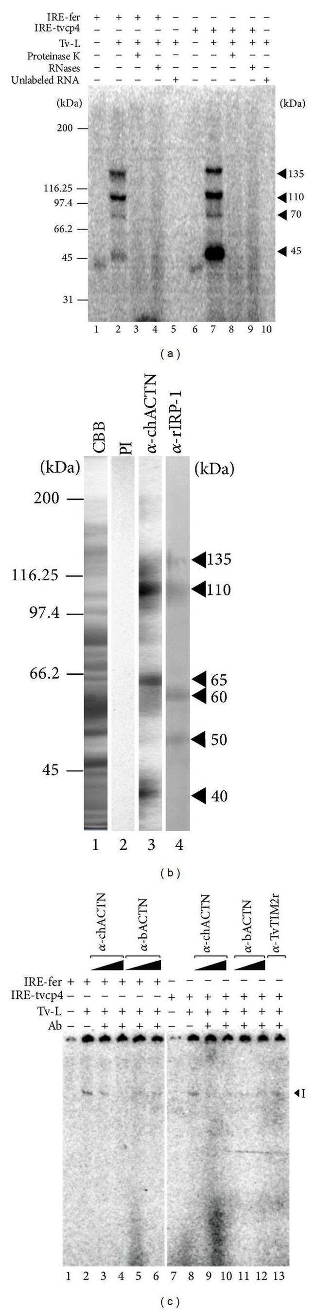 alpha Actinin 1 Antibody in Gel Shift (GS)