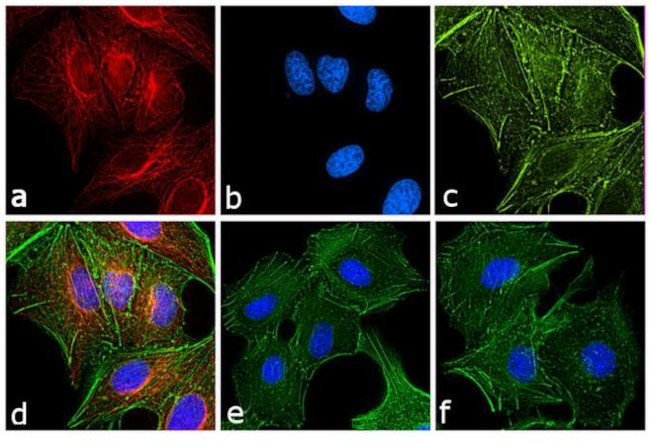 Rat IgG (H+L) Secondary Antibody in Immunocytochemistry (ICC/IF)