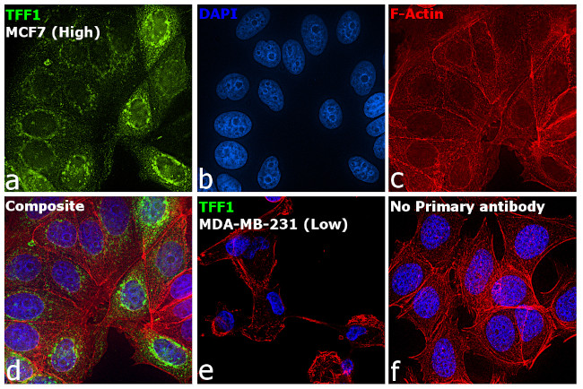 TFF1 Antibody in Immunocytochemistry (ICC/IF)