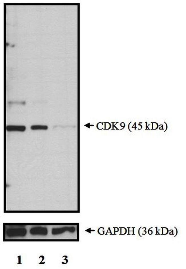 CDK9 Antibody in Western Blot (WB)
