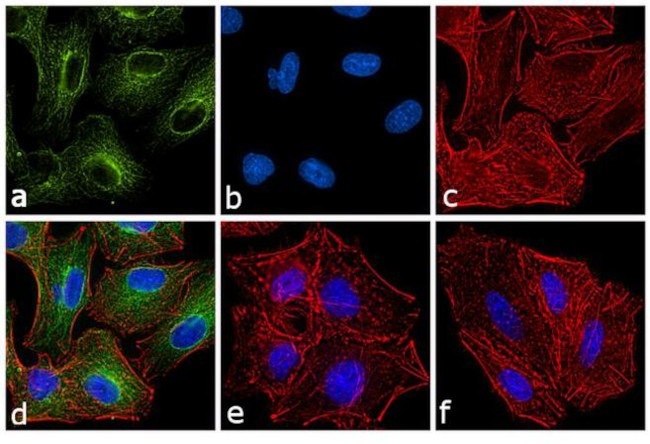 Rat IgG (H+L) Secondary Antibody in Immunocytochemistry (ICC/IF)