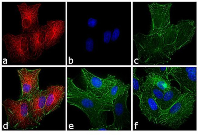 Rat IgG (H+L) Secondary Antibody in Immunocytochemistry (ICC/IF)