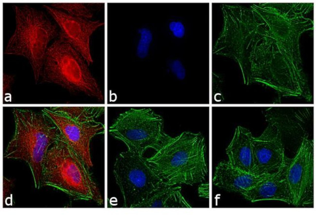 Rat IgG (H+L) Secondary Antibody in Immunocytochemistry (ICC/IF)