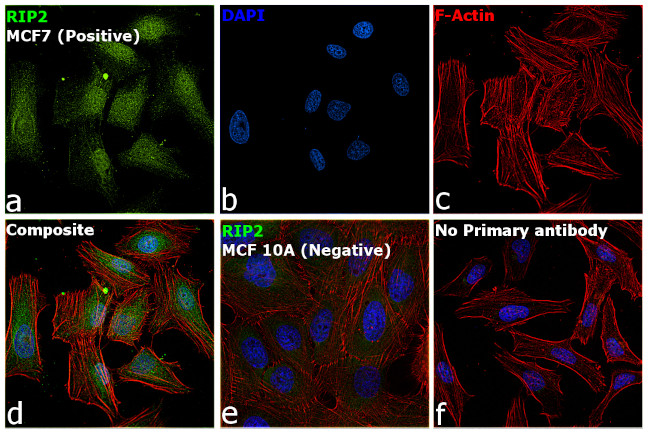 RIP2 Antibody in Immunocytochemistry (ICC/IF)