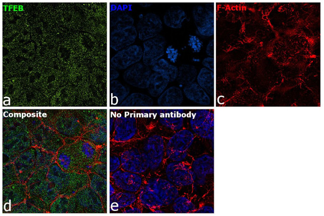 TFEB Antibody in Immunocytochemistry (ICC/IF)