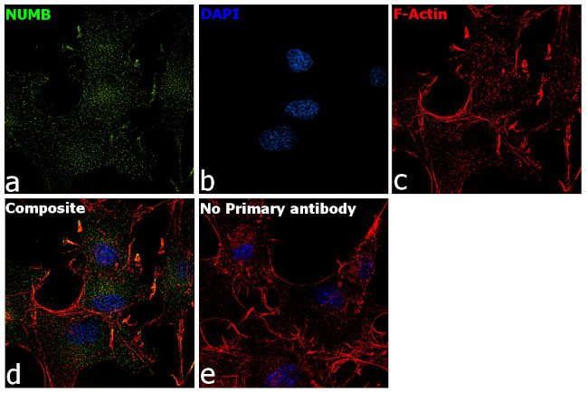 NUMB Antibody in Immunocytochemistry (ICC/IF)