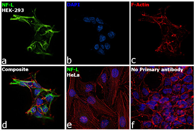 NEFL Antibody in Immunocytochemistry (ICC/IF)