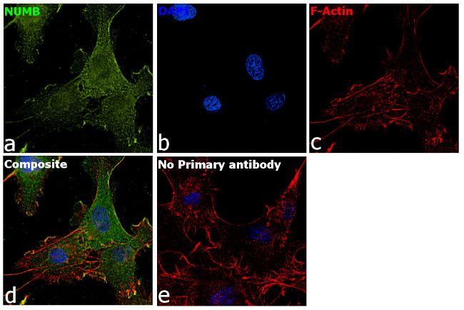 NUMB Antibody in Immunocytochemistry (ICC/IF)