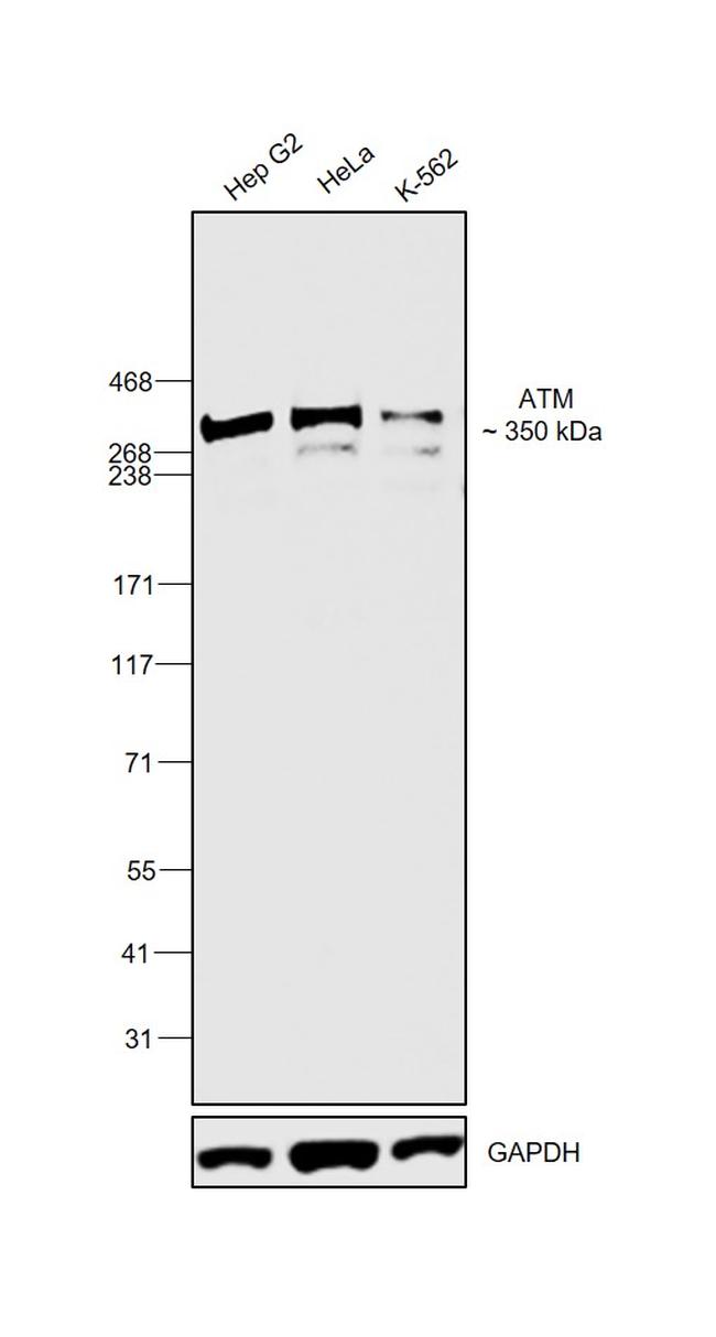 ATM Antibody in Western Blot (WB)