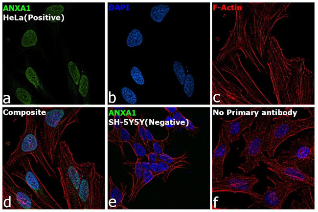 Annexin A1 Antibody in Immunocytochemistry (ICC/IF)