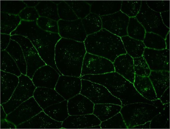 Claudin 1 Antibody in Immunohistochemistry (IHC)