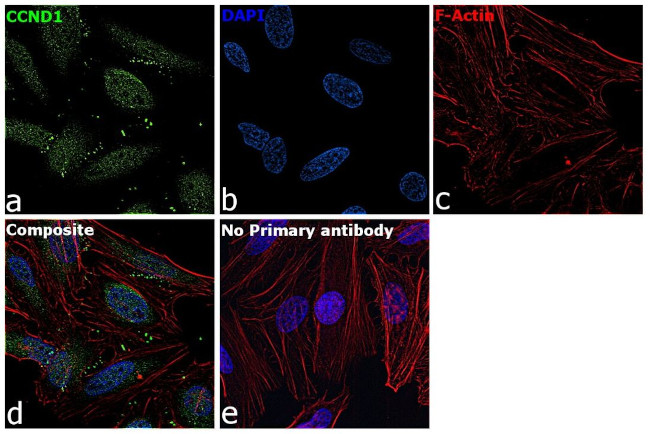 Cyclin D1 Antibody in Immunocytochemistry (ICC/IF)