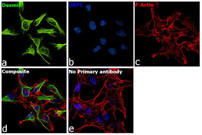 Desmin Antibody in Immunocytochemistry (ICC/IF)