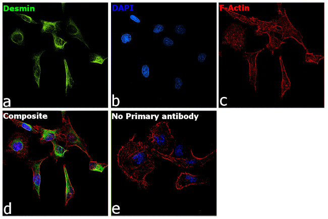 Desmin Antibody in Immunocytochemistry (ICC/IF)