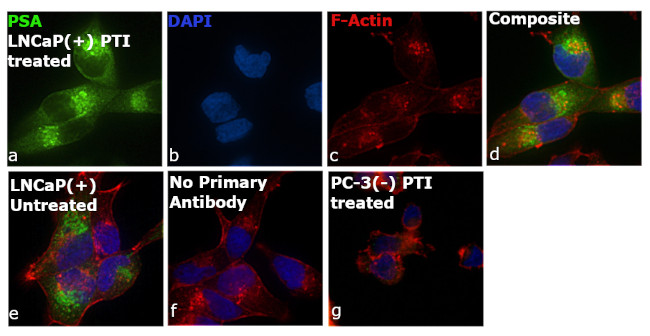 PSA Antibody in Immunocytochemistry (ICC/IF)