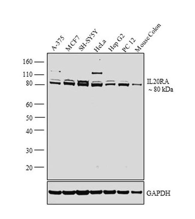 IL20RA Antibody in Western Blot (WB)