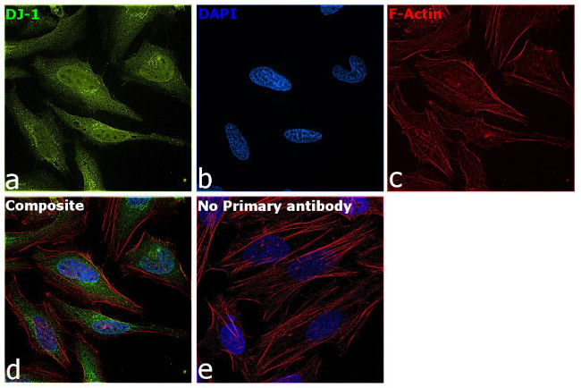 DJ-1 Antibody in Immunocytochemistry (ICC/IF)