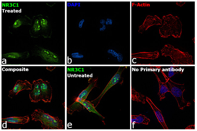 Glucocorticoid Receptor Antibody in Immunocytochemistry (ICC/IF)