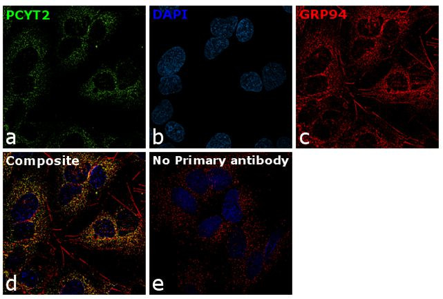 PCYT2 Antibody in Immunocytochemistry (ICC/IF)