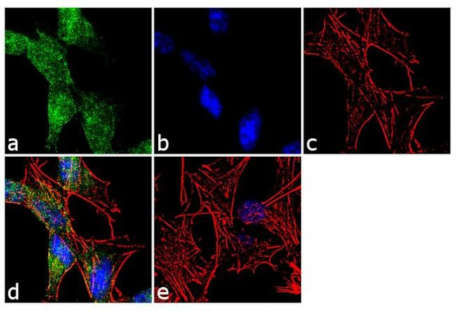 VAMP1 Antibody in Immunocytochemistry (ICC/IF)