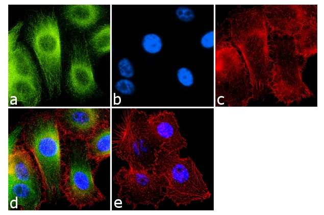 FOXP3 Antibody in Immunocytochemistry (ICC/IF)