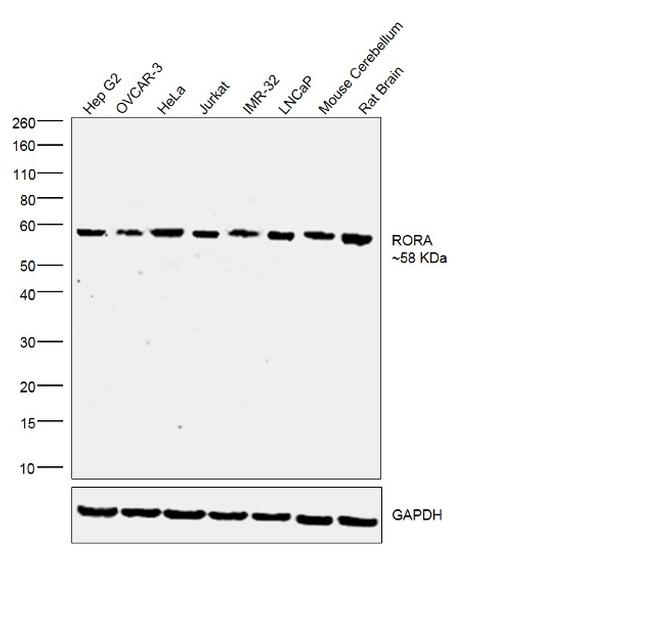 RORA Antibody in Western Blot (WB)