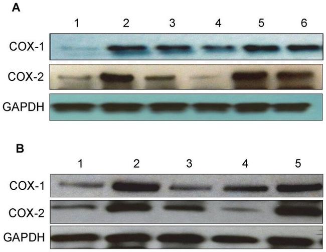 COX1 Antibody in Western Blot (WB)