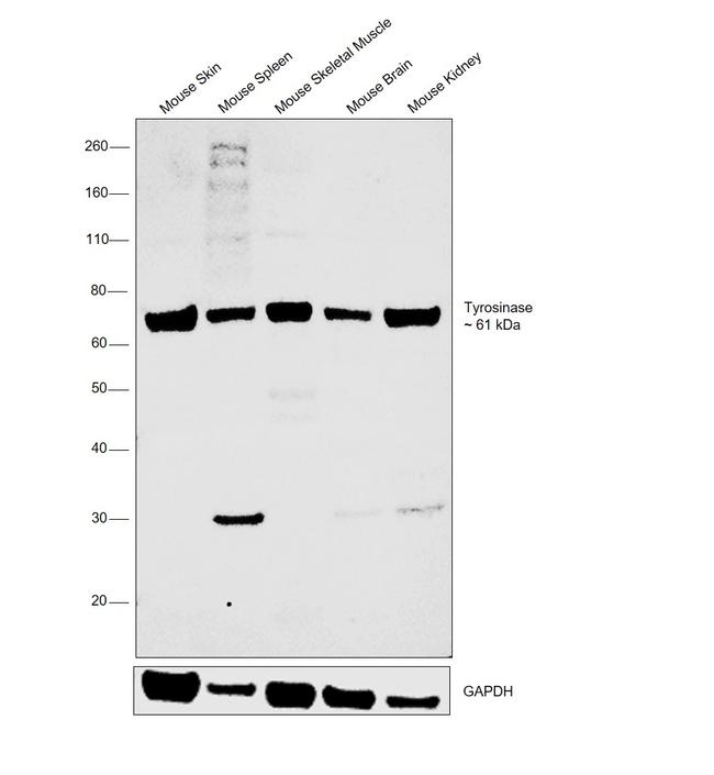 Tyrosinase Antibody in Western Blot (WB)