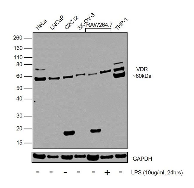 VDR Antibody in Western Blot (WB)