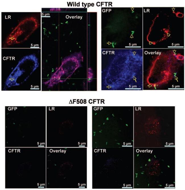 Cftr Ab CFTR Polyclonal Antibody | Invitrogen (PA1-935)