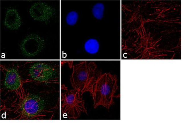 PSMD2 Antibody in Immunocytochemistry (ICC/IF)