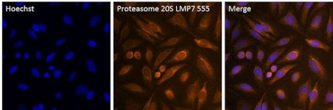 PSMB8 Antibody in Immunocytochemistry (ICC/IF)