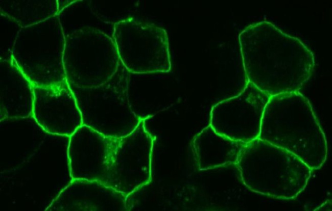 GPR20 Antibody in Immunocytochemistry (ICC/IF)
