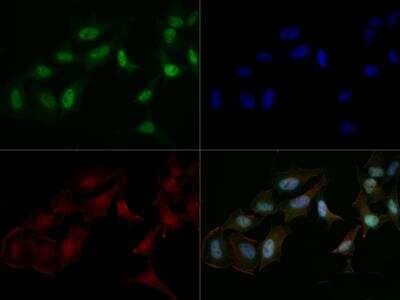 MRE11 Antibody in Immunocytochemistry (ICC/IF)