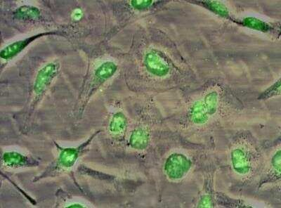 NBS1 Antibody in Immunocytochemistry (ICC/IF)