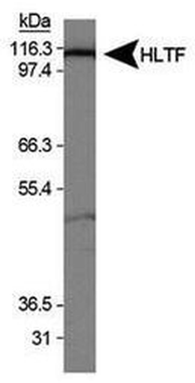 SMARCA3 Antibody in Western Blot (WB)