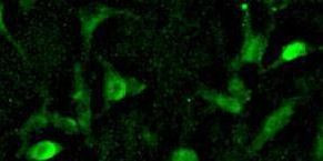 DNMT1 Antibody in Immunocytochemistry (ICC/IF)