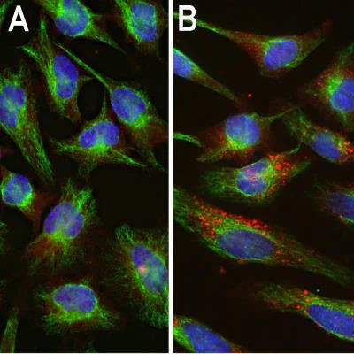 Ubiquitin Antibody in Immunocytochemistry (ICC/IF)