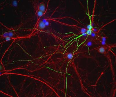 Peripherin Antibody in Immunocytochemistry (ICC/IF)